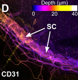 CD31